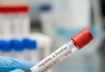 Crecen los casos de hepatitis A en el país y encontraron otro virus poco conocido